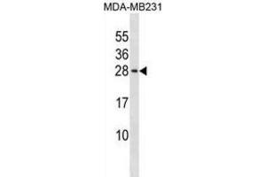 Western Blotting (WB) image for anti-Peptidyl Prolyl Cis/Trans Isomerase NIMA Interacting 4 Protein (PIN4) antibody (ABIN3000322)