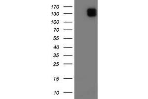 HEK293T cells were transfected with the pCMV6-ENTRY control (Left lane) or pCMV6-ENTRY ENPEP (Right lane) cDNA for 48 hrs and lysed. (ENPEP antibody)