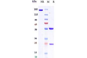 Anti-CCL20 Reference Antibody (GSK3050002) on SDS-PAGE under reducing (R) condition.