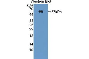 Western blot analysis of the recombinant protein. (Dysferlin antibody  (AA 1-479))