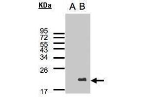 WB Image Western Blot analysis of UBE2C expression in transfected 293T cell line by UBE2C polyclonal antibody. (UBE2C antibody)