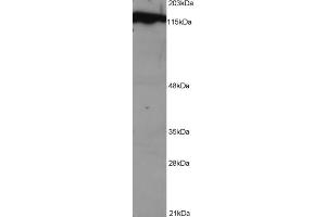 Western Blotting (WB) image for anti-Damage Specific DNA Binding Protein 1 (DDB1) (C-Term) antibody (ABIN184570)