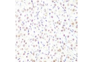Immunohistochemistry of paraffin-embedded rat ovary using H3K9me1 antibody.