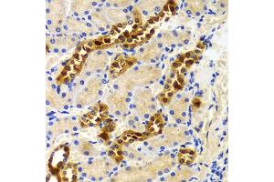 Immunohistochemistry of paraffin-embedded rat kidney using PIWIL4 antibody (ABIN5971612) at dilution of 1/100 (40x lens). (PIWIL4 antibody)