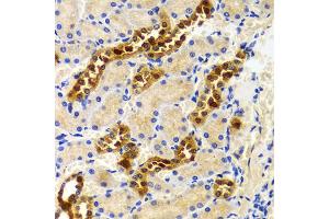 Immunohistochemistry of paraffin-embedded rat kidney using PIWIL4 antibody (ABIN5971612) at dilution of 1/100 (40x lens).