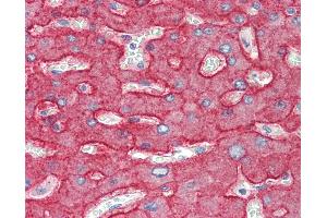 Anti-ASGR1 / ASGPR antibody IHC staining of human liver. (Asialoglycoprotein Receptor 1 antibody  (AA 100-149))
