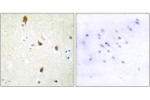 Immunohistochemistry analysis of paraffin-embedded human brain tissue, using 5-HT-2B Antibody. (Serotonin Receptor 2B antibody  (AA 261-310))