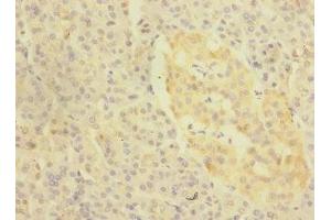 Immunohistochemistry of paraffin-embedded human pancreatic tissue using ABIN7157698 at dilution of 1:100 (KREMEN1 antibody  (AA 180-380))