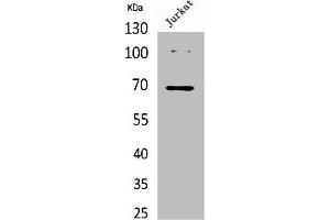 Western Blotting (WB) image for anti-X-Ray Repair Complementing Defective Repair in Chinese Hamster Cells 6 (XRCC6) (acLys542) antibody (ABIN7185695)