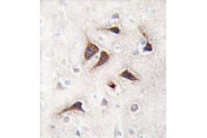 Formalin-fixed and paraffin-embedded human brain tissue reacted with CAMK2 delta Antibody (C-term) , which was peroxidase-conjugated to the secondary antibody, followed by DAB staining. (CAMK2D antibody  (C-Term))