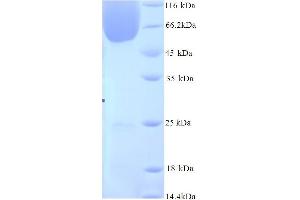 SDS-PAGE (SDS) image for BCL2-Associated Athanogene 3 (BAG3) (AA 2-577) protein (His tag) (ABIN5714470) (BAG3 Protein (AA 2-577) (His tag))