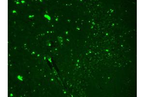Immunohistochemistry (IHC) image for anti-Sodium Channel, Voltage-Gated, Type IX, alpha Subunit (SCN9A) (AA 1751-1946) antibody (FITC) (ABIN2483098)