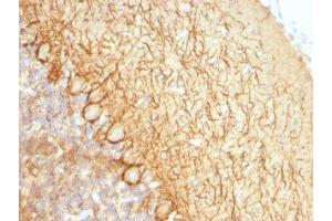 Formalin-fixed, paraffin-embedded rat cerebellum stained with Neurofilament antibody (NR-4). (Neurofilament antibody)