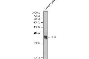 Western blot analysis of extracts of Mouse brain, using RhoB pAb  at 1:1000 dilution. (RHOB antibody  (C-Term))