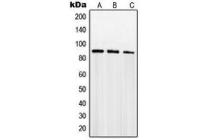 Western blot analysis of SENP5 expression in PC12 (A), Jurkat (B), NIH3T3 (C) whole cell lysates.