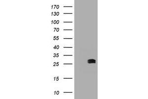 Image no. 2 for anti-B-Cell CLL/lymphoma 10 (BCL10) antibody (ABIN1496848) (BCL10 antibody)