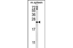 RA Antibody (C-term) 2949b western blot analysis in mouse spleen tissue lysates (35 μg/lane). (RAP1A antibody  (C-Term))