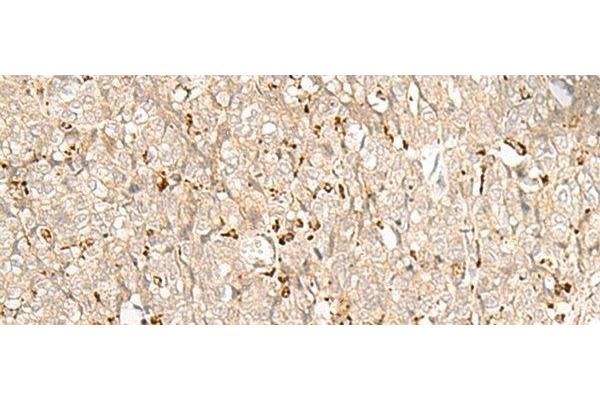 NUP210 antibody