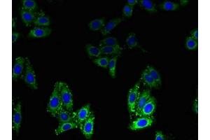 Immunofluorescent analysis of HepG2 cells using ABIN7145600 at dilution of 1:100 and Alexa Fluor 488-congugated AffiniPure Goat Anti-Rabbit IgG(H+L) (BLOC1S1 antibody  (AA 1-153))