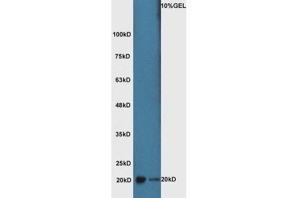 ATF3 antibody  (AA 51-150)