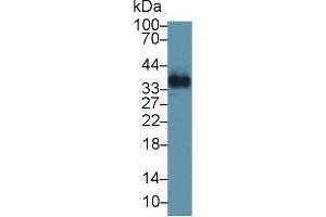 Western Blot; Sample: Human Lung lysate; Primary Ab: 1µg/ml Rabbit Anti-Human OGN Antibody Second Ab: 0. (OGN antibody  (AA 180-298))