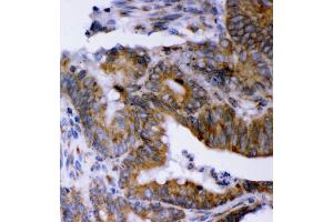 IHC analysis of LYRIC using anti-LYRIC antibody (ABIN7599627). (MTDH antibody  (AA 101-270))
