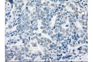 Immunohistochemical staining of paraffin-embedded colon tissue using anti-XRCC4mouse monoclonal antibody. (XRCC4 antibody)