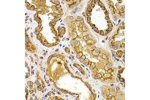 Immunohistochemistry of paraffin-embedded human kidney using BMP15 antibody (ABIN5975746) at dilution of 1/100 (40x lens).
