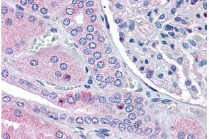 Human Kidney (formalin-fixed, paraffin-embedded) stained with RNF213 antibody ABIN290197 at 2. (RNF213 antibody  (AA 5244-5254))