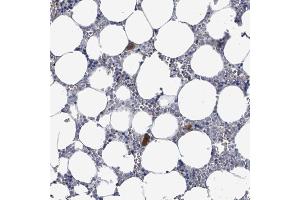 Immunohistochemical staining (Formalin-fixed paraffin-embedded sections) of human bone marrow with LILRA4 polyclonal antibody  shows strong cytoplasmic positivity in hematopoietic cells / megakaryocytes. (LILRA4 antibody  (AA 159-211))