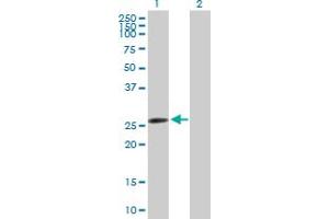 Western Blot analysis of AK2 expression in transfected 293T cell line by AK2 MaxPab polyclonal antibody. (Adenylate Kinase 2 antibody  (AA 1-239))