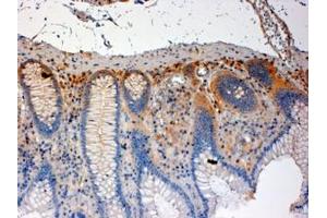 ABIN184606 (4µg/ml) staining of paraffin embedded Human Colon. (CSK antibody  (C-Term))