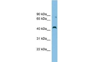 WB Suggested Anti-CCBE1 Antibody Titration: 0.