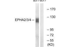 Western blot analysis of extracts from MCF7 cells, using EPHA2/3/4 (Ab-588/596) antibody. (EPH Receptor A2 antibody  (Tyr588, Tyr596))
