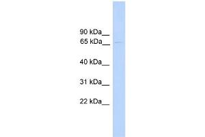 WB Suggested Anti-PAntibody Titration:  0. (PARP6 antibody  (N-Term))