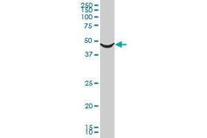 ADRA1A monoclonal antibody (M02), clone 5G8. (alpha 1 Adrenergic Receptor antibody  (AA 1-27))