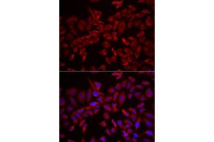 Immunofluorescence analysis of HeLa cell using CSRP3 antibody. (CSRP3 antibody)