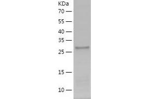 Western Blotting (WB) image for AlkB, Alkylation Repair Homolog 3 (ALKBH3) (AA 1-286) protein (His tag) (ABIN7288441) (ALKBH3 Protein (AA 1-286) (His tag))