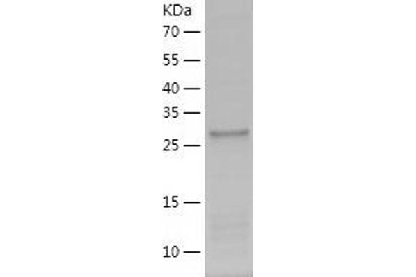 ALKBH3 Protein (AA 1-286) (His tag)