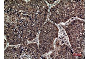 Immunohistochemistry (IHC) analysis of paraffin-embedded Human Lung, antibody was diluted at 1:100. (STX1A antibody  (Internal Region))