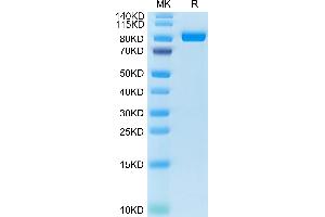 FAP Protein (AA 26-760) (His tag)