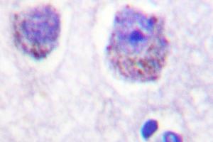 Image no. 1 for anti-Ribosomal Protein S6 Kinase, 70kDa, Polypeptide 1 (RPS6KB1) antibody (ABIN272052) (RPS6KB1 antibody)