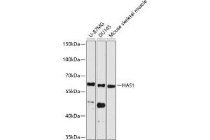 Western blot analysis of extracts of various cell lines, using H antibody (ABIN6129577, ABIN6141611, ABIN6141612 and ABIN6214712) at 1:1000 dilution. (HAS1 antibody  (AA 80-390))