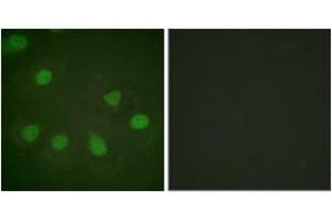 Immunofluorescence analysis of HeLa cells, using Retinoblastoma (Ab-249) Antibody. (Retinoblastoma Protein (Rb) antibody  (AA 211-260))