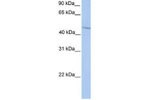 WB Suggested Anti-HOXA13 Antibody Titration: 0. (HOXA13 antibody  (Middle Region))