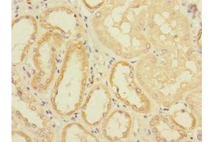 Immunohistochemistry (IHC) image for anti-Eukaryotic Translation Initiation Factor 4E Family Member 2 (EIF4E2) (AA 1-240) antibody (ABIN7152192)