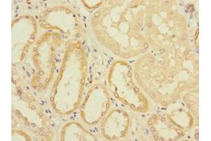 Immunohistochemistry of paraffin-embedded human kidney tissue using ABIN7152192 at dilution of 1:100 (EIF4E2 antibody  (AA 1-240))