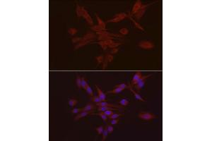Immunofluorescence analysis of PC-12 using S100 antibody (ABIN7270123) at dilution of 1:25 (40x lens). (S100A10 antibody  (AA 1-97))