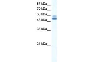 Western Blotting (WB) image for anti-Lysine (K)-Specific Demethylase 4D (KDM4D) antibody (ABIN2461248)