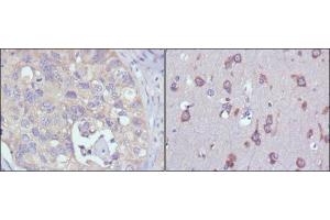 Immunohistochemical analysis of paraffin-embedded human lung cancer (left) and human brain (right) tissues using MPS1 mouse mAb with DAB staining. (Mps1 antibody)